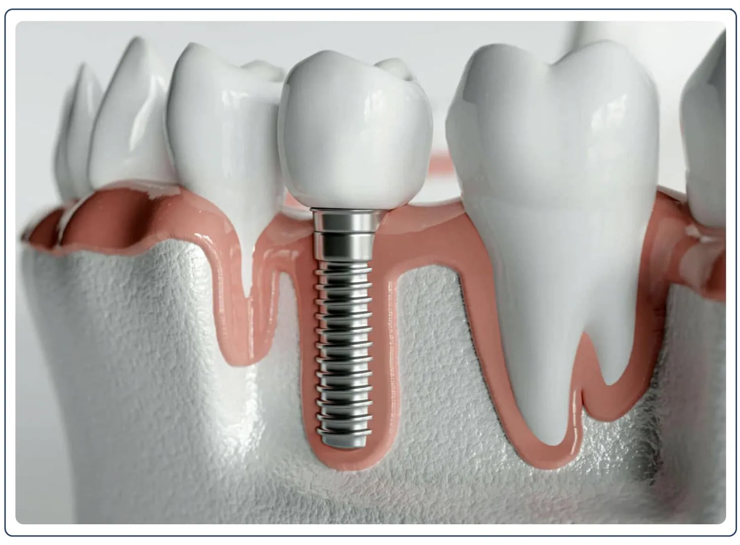 Şehir Hayatı, Stres ve Diş Kayıpları